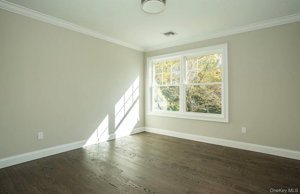 28 Fern Drive E - Photo 7