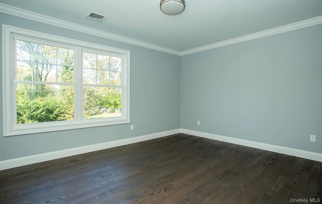 28 Fern Drive E - Photo 5